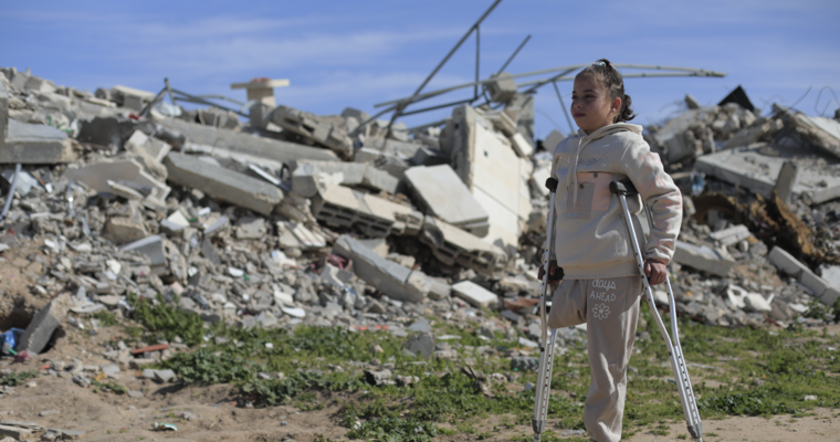 gaza amputees
